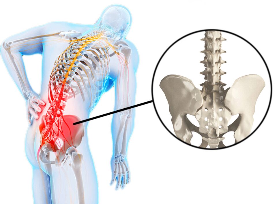 Spinal pathologies are a common cause of back pain