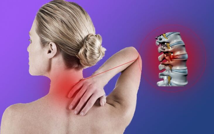 Inflammation of the spine with cervical osteocondrosis