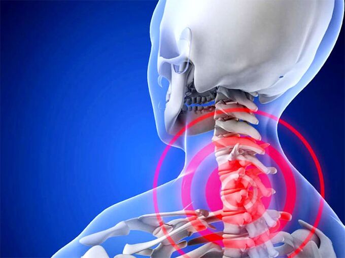 Inflammatory Cervical region