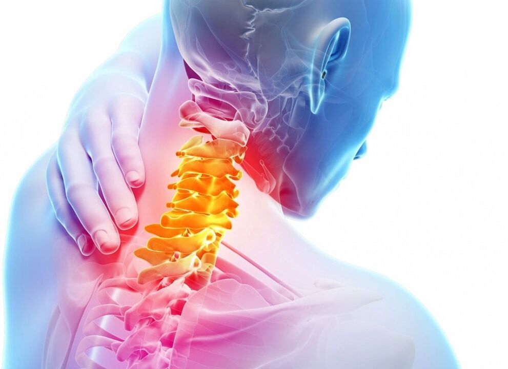 What is cervical osteocondrosis