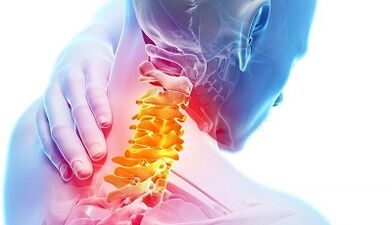 Causes of cervical osteocondrosis
