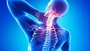 Complications of the osteocondrosis of the cervical spine