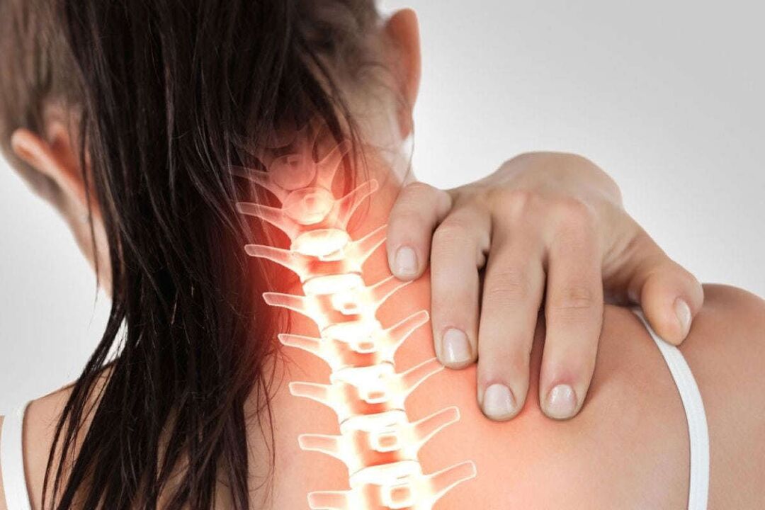 Manifests of cervical osteocondrosis